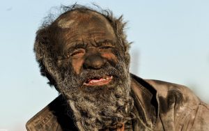 80 year old non-bathing man on encurious
